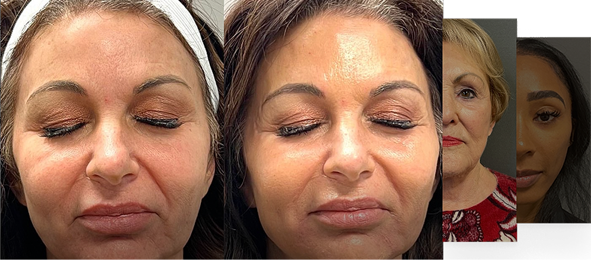 Charlotte Plastic Surgery patient before and after