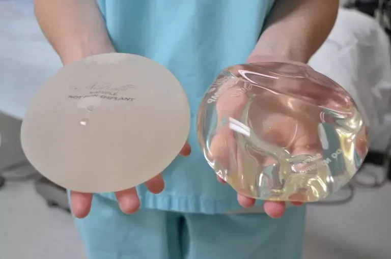 breast implant removal